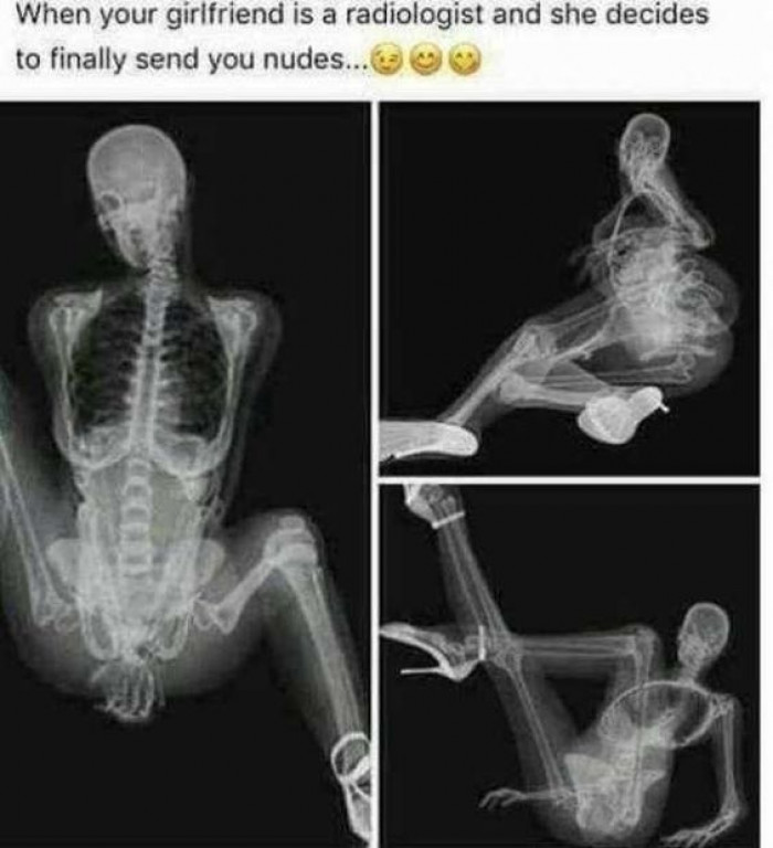 When Your Girlfriend Is A Radiologist