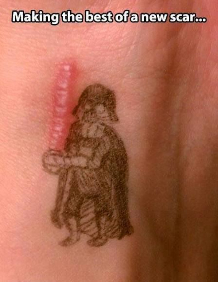 Darth Vader scar