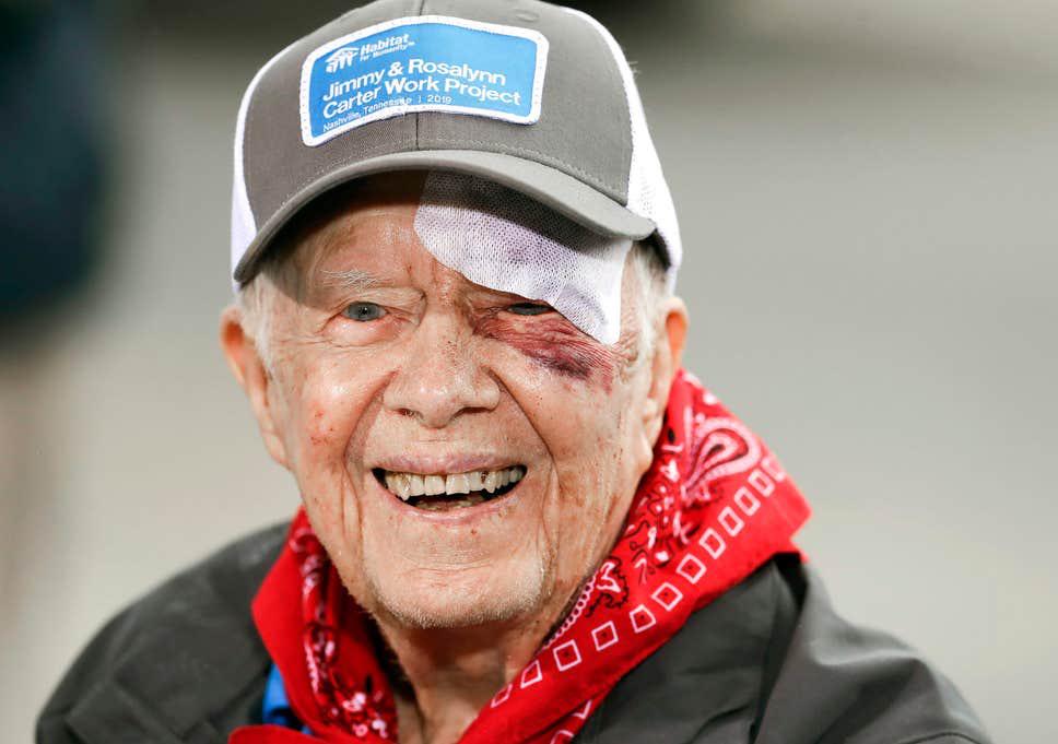 Nothing seems to slow Jimmy Carter down. After beating cancer, 14 stitches and a black eye ain’t nothing.