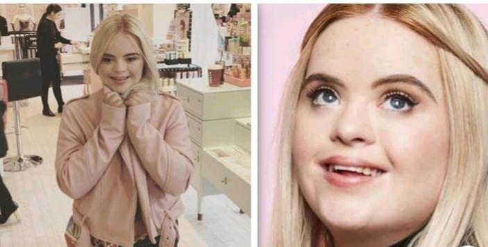 Model with Down syndrome becomes the face of the beauty brand "benefit cosmetics"