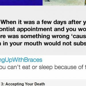 21 Pictures That Only People Grew Up Wearing Braces Will Understand